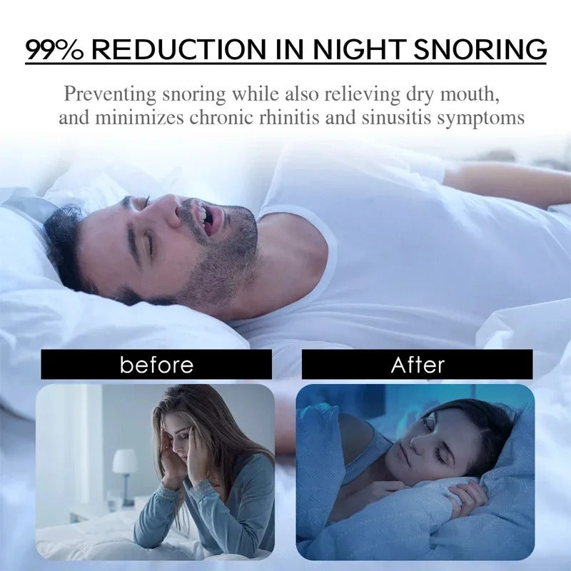 Anti Snoring Mouth Tape - Verdant Bros